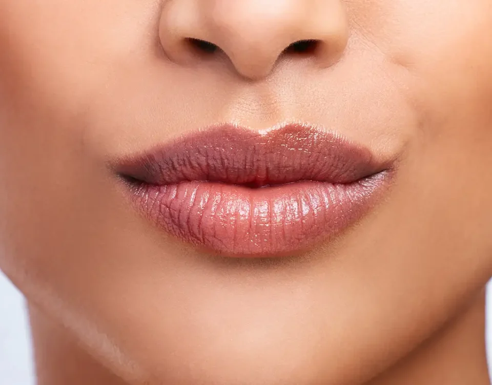 lip fillers miami