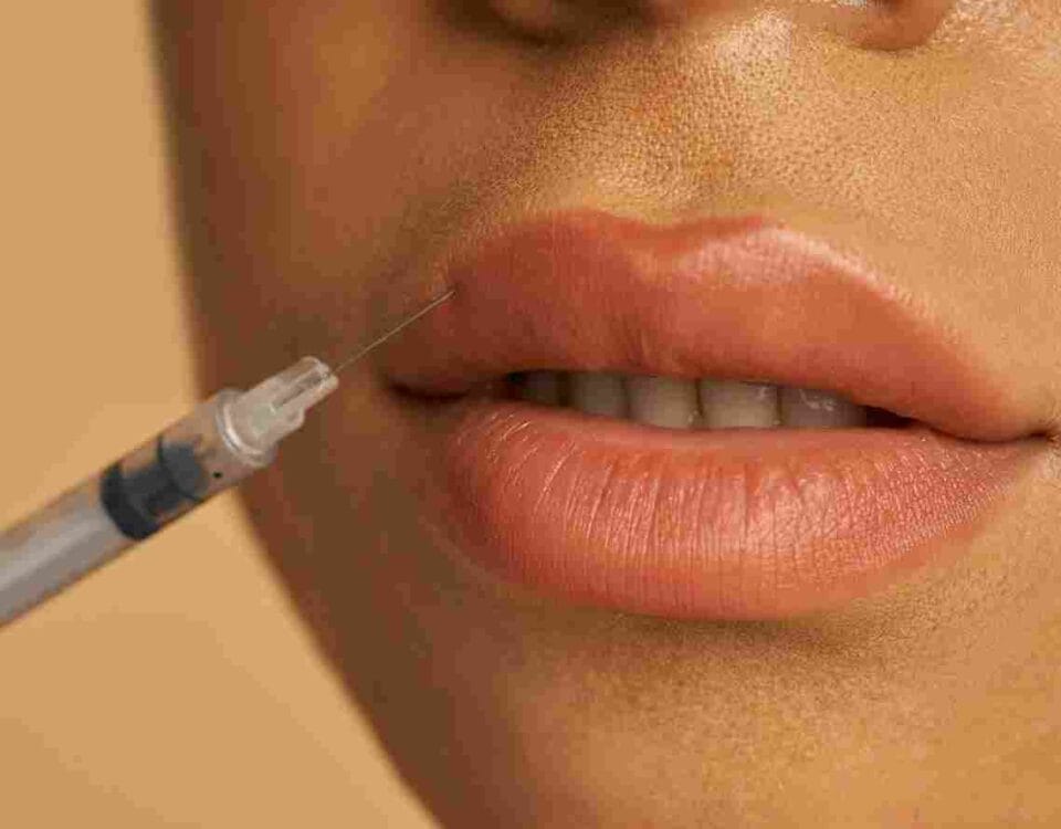 lip fillers miami