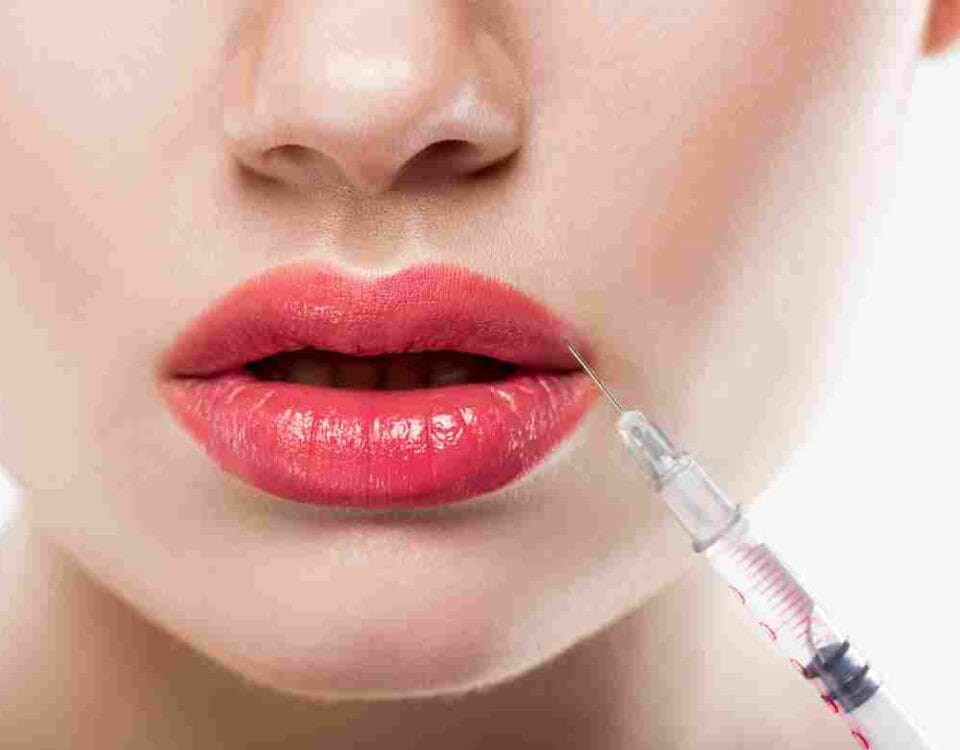 lip fillers in miami