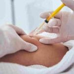 best kybella clinic in miami