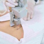 kybella injection treatment in miami