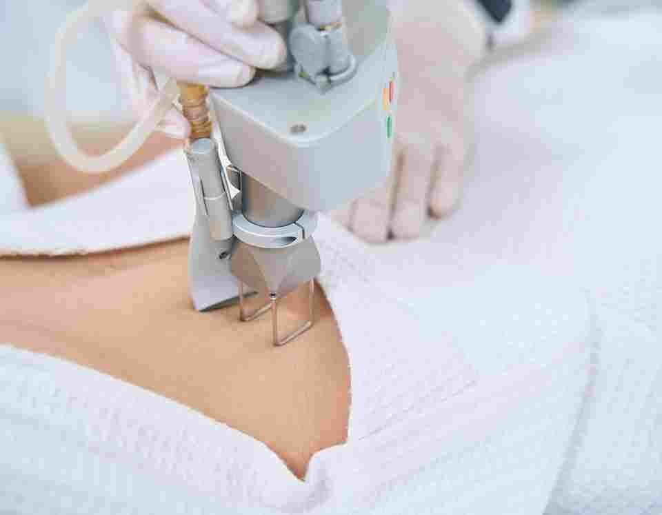 kybella injection treatment in miami