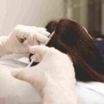 hair restoration miami fl
