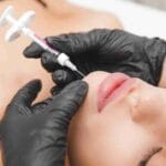 hyaluronic acid fillers near miami
