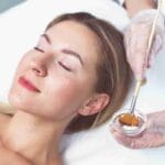 chemical peels near miami