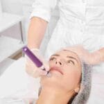 mesoneedling for collagen boost