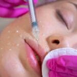 hyaluronic acid fillers miami