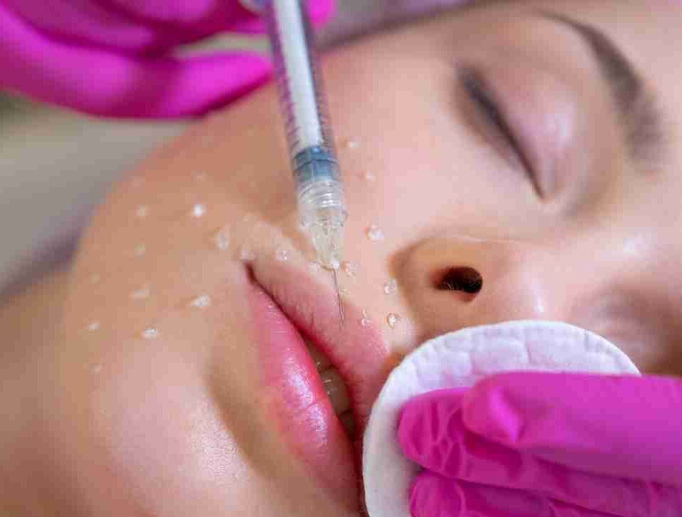 hyaluronic acid fillers miami