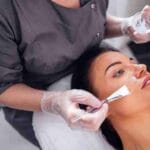 chemical peels miami