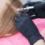 anteage exosome hair restoration near me