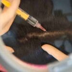 anteage exosome hair restoration cost