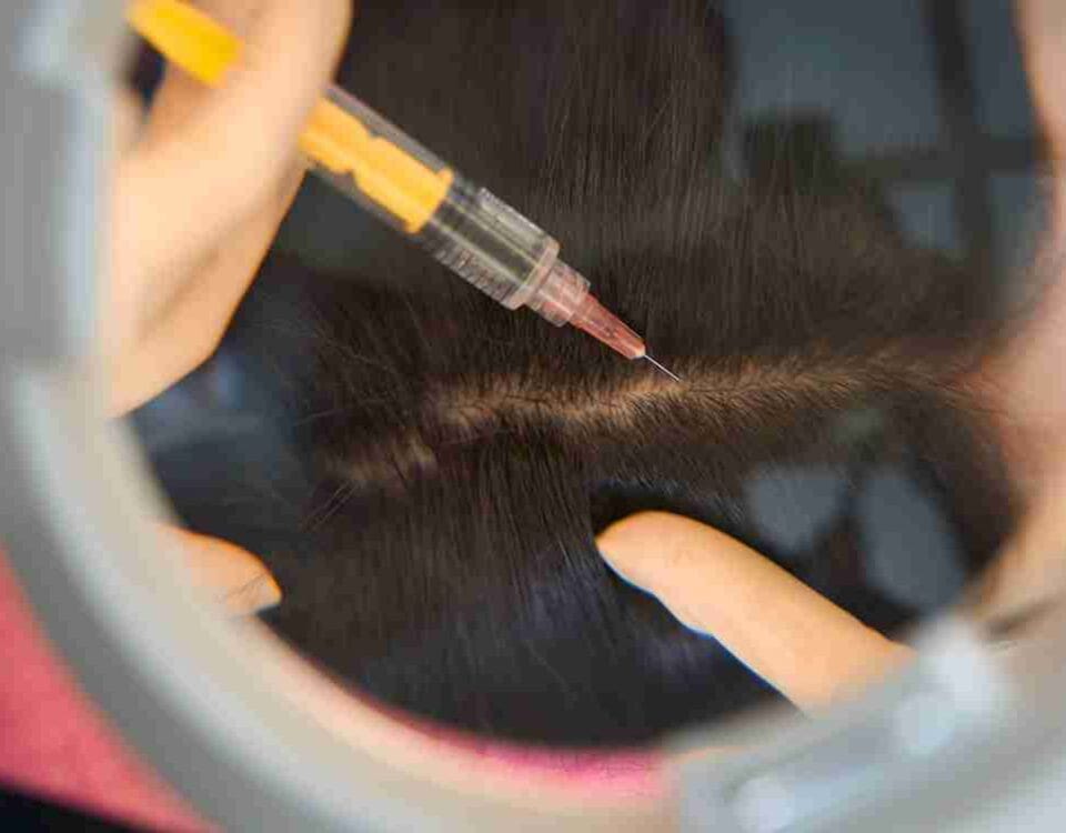 anteage exosome hair restoration cost