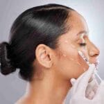 botox near miami
