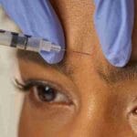 botox coral gables