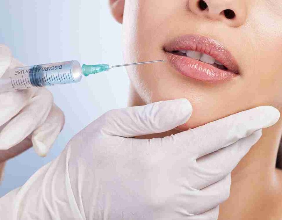 best place to get lip fillers in miami