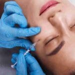 botox special near me