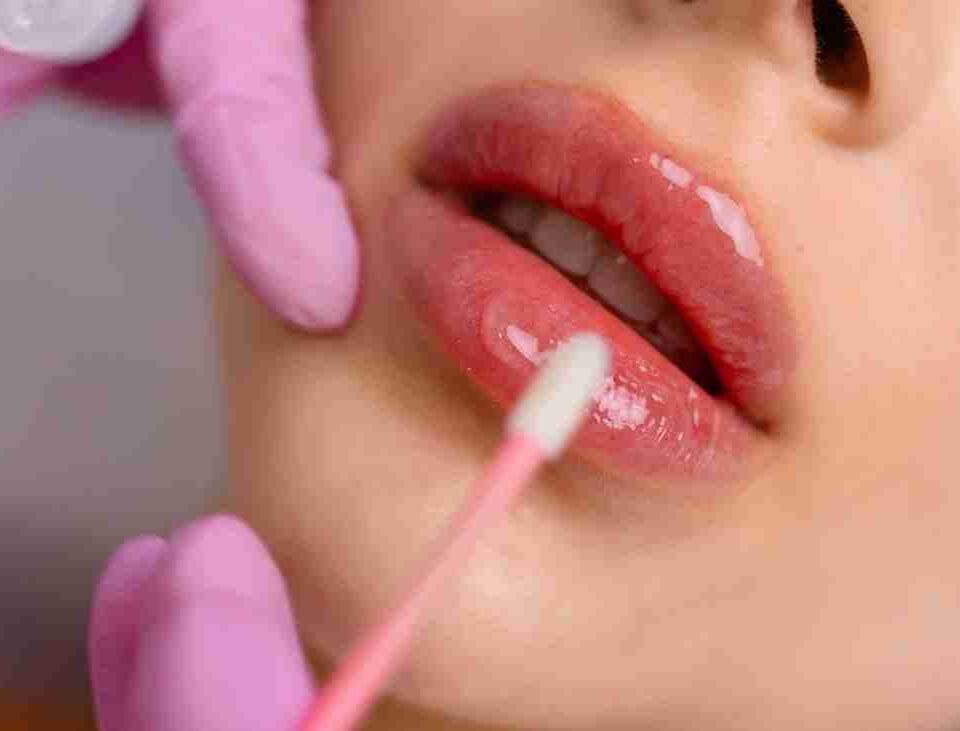 how much are lip fillers