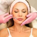 lip filler specials near me