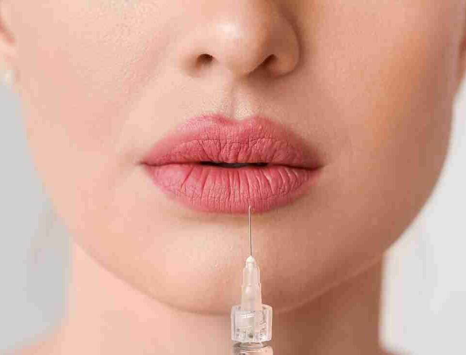 best lip filler