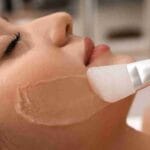 best chemical peels