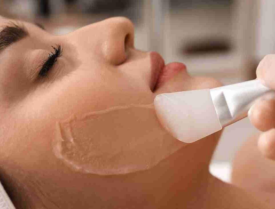 best chemical peels