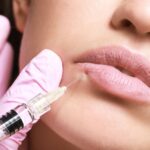 Find trusted lip filler specials near you in Coral Gables, FL. Expert guide to quality deals, safety tips, and professional treatments at Pōk Aesthetic Bar.