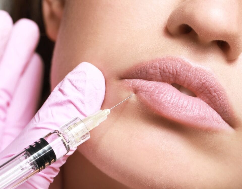 Find trusted lip filler specials near you in Coral Gables, FL. Expert guide to quality deals, safety tips, and professional treatments at Pōk Aesthetic Bar.