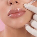 best-lip-injection-filler-guide-2025