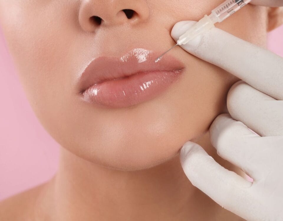 best-lip-injection-filler-guide-2025