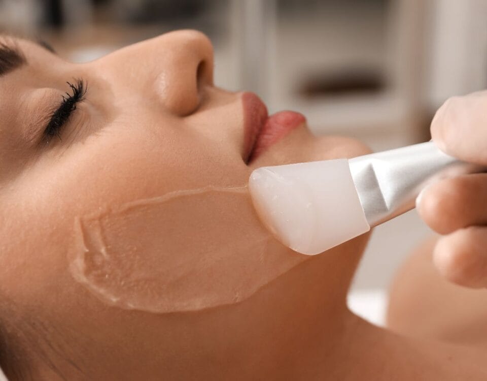 best chemical peel for hyperpigmentation