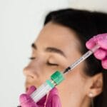 prp therapy hair restoration coral gables
