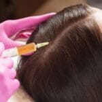 Discover how PRP therapy hair restoration in Coral Gables helps regrow natural hair safely and effectively at Pōk Aesthetic Bar. Book your session today!
