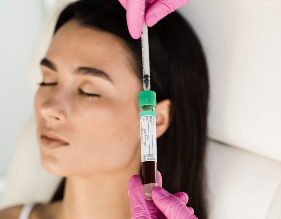 Discover PRP hair injections in Coral Gables at Pōk Aesthetic Bar. Restore hair naturally with safe, non-surgical, and lasting results you’ll love.