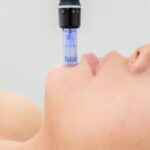 Discover how radio frequency microneedling reduces scars, wrinkles, and tightens skin with minimal downtime. Expert guide to results and benefits.