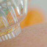 RF Microneedling