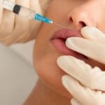 best lip injections near me