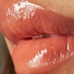 Lip Filler Guide: Benefits, Costs & What to Expect