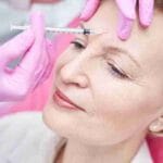 best-places-to-get-botox-coral-gables-fl