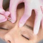 best-places-to-get-botox-on-the-face-coral-gables-fl
