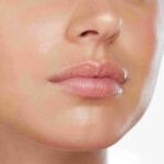 best med spa for subtle lip filler Miami