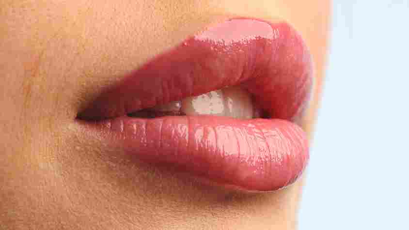 lip-filler-near-coral-gables-miami