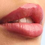 how-to-find-a-good-lip-filler-clinic-in-miami