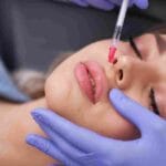 Discover which foods to avoid after lip filler in Miami to protect your results, reduce swelling, and heal faster after treatment.