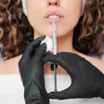 where-should-i-get-lip-fillers