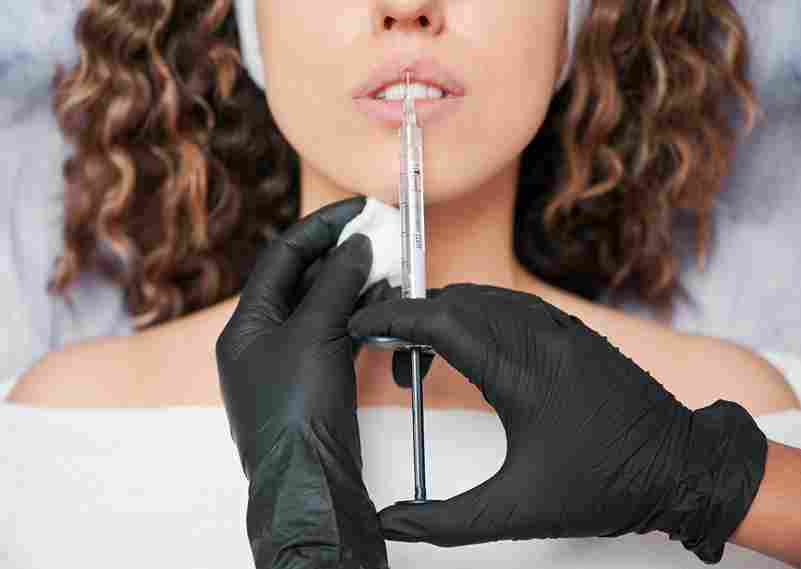 where-should-i-get-lip-fillers
