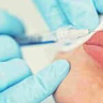 Wondering why does lip filler migrate? Learn the causes, prevention tips, and how Pōk Aesthetic Bar in Coral Gables, FL can help.