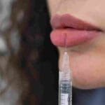 Wondering how long does lip fillers last? Discover results, factors & expert lip filler treatments at Pōk Aesthetic Bar in Miami.