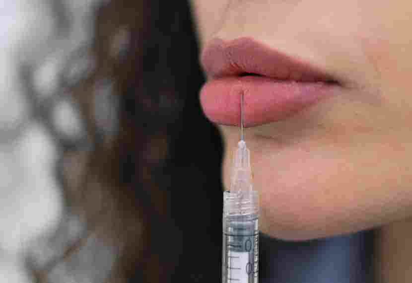 Wondering how long does lip fillers last? Discover results, factors & expert lip filler treatments at Pōk Aesthetic Bar in Miami.