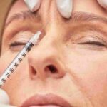 What You're Really Getting When You Choose Affordable Botox in Coral Gables