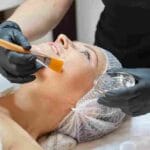 Chemical Peel at a Miami Med Spa | What to Expect